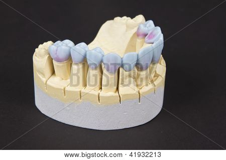 Dentadura de cera