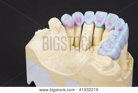Wax gebit