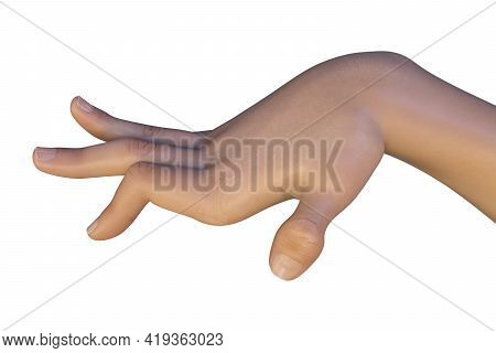 A Hand Of A Child With Chorea, A Hyperkinetic Movement Disorder. 3d Illustration Showing Brief, Irre