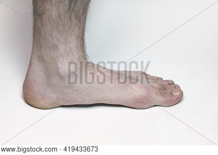 Man Feet On White Background, Hairy Leg European, With Clipping Path For Isolating