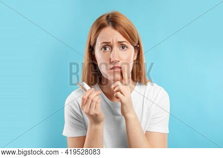 Upset Woman With Herpes Applying Cream On Lips Against Light Blue Background