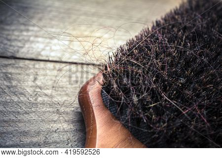 Macro Of A Brush With Long Hairs - Alopecia Hair Loss Concept