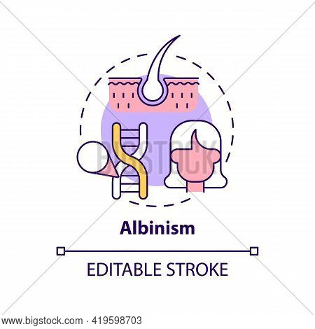 Albinism Concept Icon. No Color In Hair. Hereditary Physical Condition. Inherited Genetic Disorder I