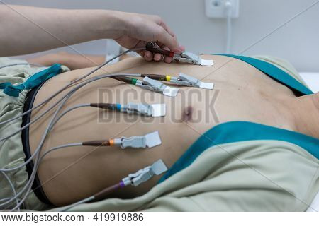 Heart Electrocardiogram Or Monitoring Using Holter For Young Patient. Male Athlete Does A Cardiac St