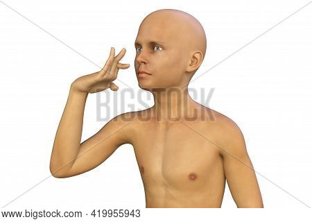 A Boy With Sydenham's Chorea And Involuntary Movements Of A Hand, 3d Illustration. An Autoimmune Dis