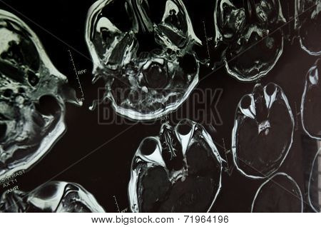 research in medicine. CT scan of the patient
