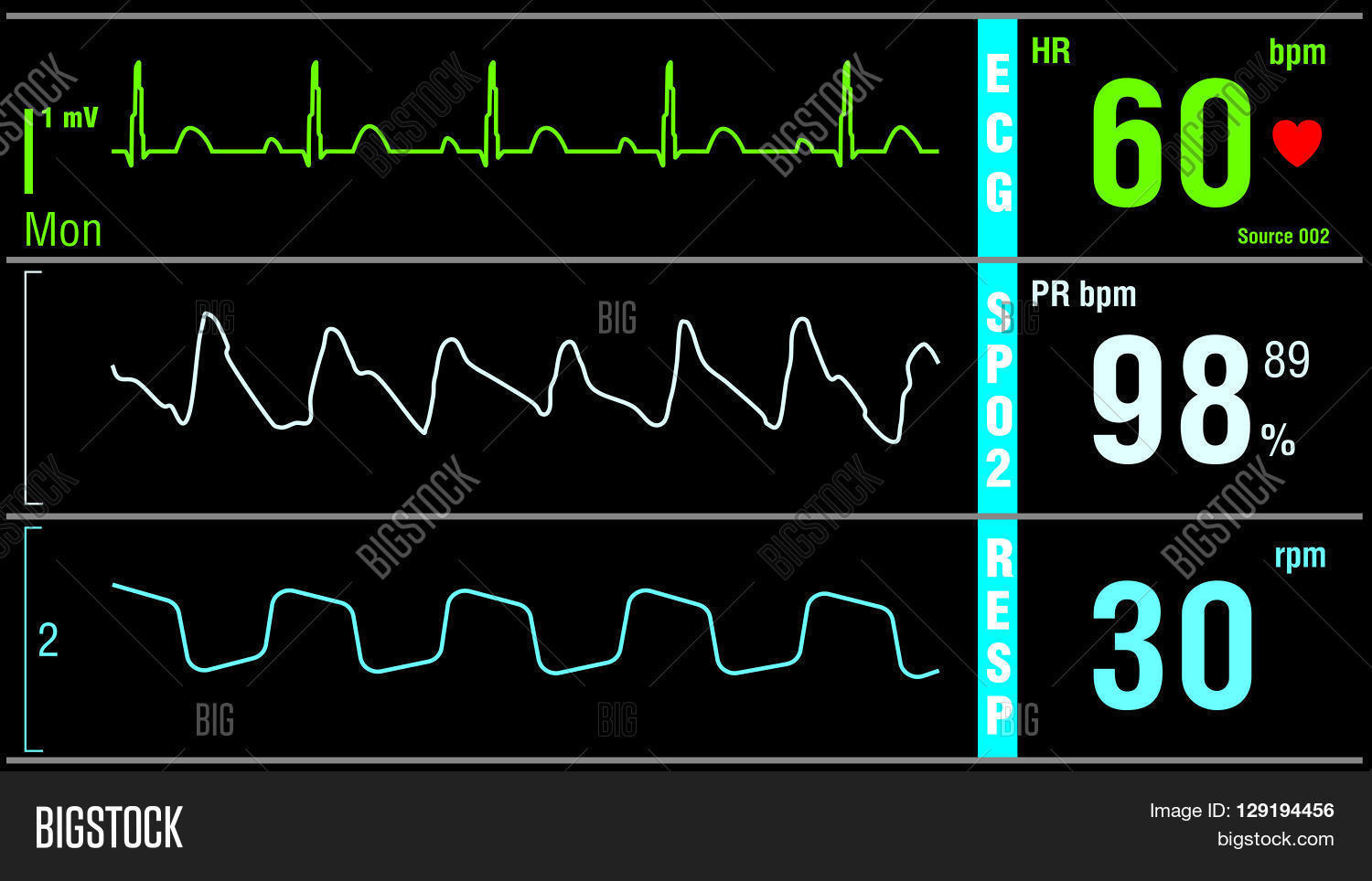 Patient Monitor Vector & Photo (Free Trial) | Bigstock