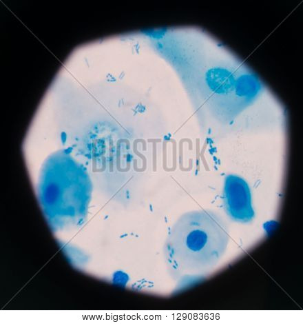 background Blue bacteria in gram stain sputum.