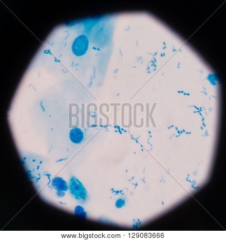 background Blue bacteria in gram stain sputum.