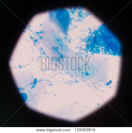 background Blue bacteria in gram stain sputum.