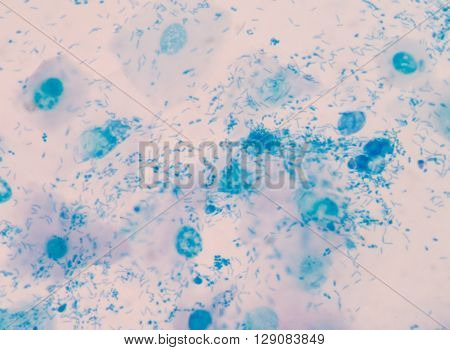 background Blue bacteria in gram stain sputum.