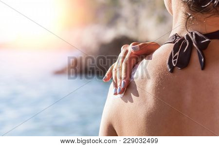 Woman Rubs Sunscreen On His Shoulder. Against The Background Of The Sea.