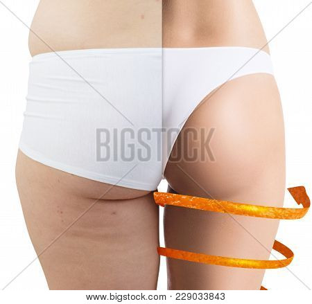 Big Spiral Arrows Shows Result Of Slimming. Female Buttocks Before And After Sport.