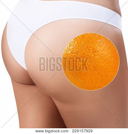 Female Buttocks With Zoom Circle Shows Orange Peel. Absence Of Cellulite Concept.