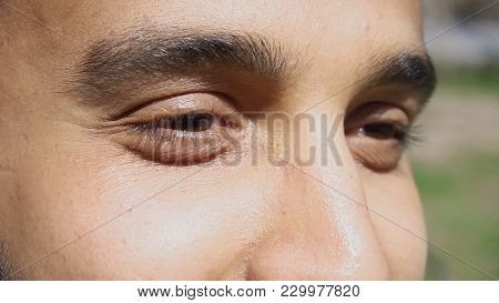 Young Man Looking Straight. Guy Has Curved Nose, Black Eyelashes And Eyebrows. Concept Of New Techno