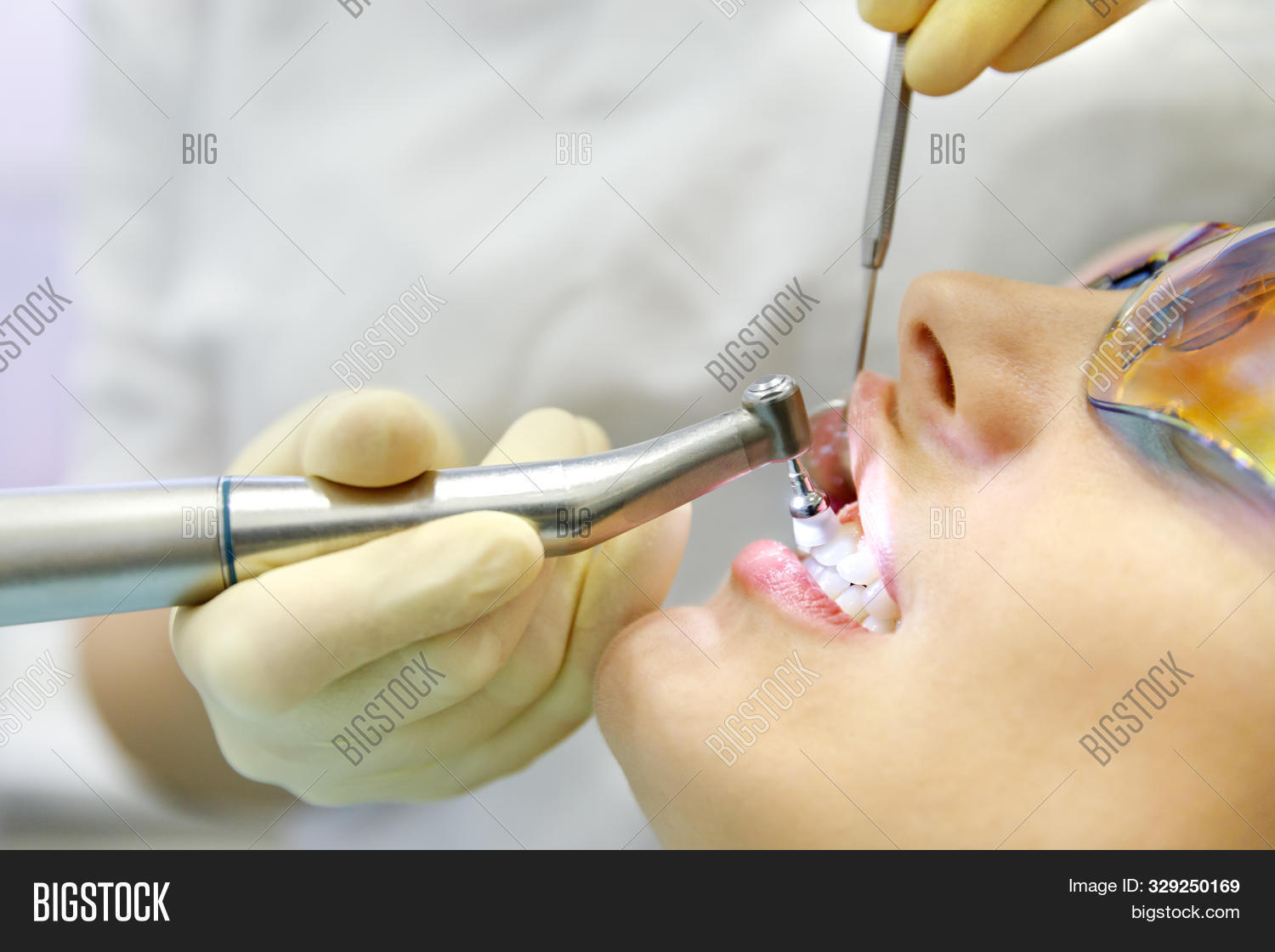 Close Dental Polishing Image & Photo (Free Trial) Bigstock