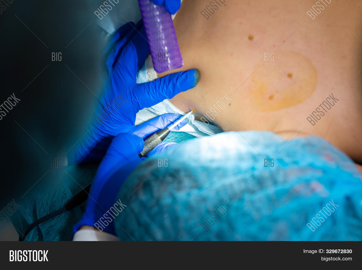 Close Surgeon Burns Image & Photo (Free Trial) Bigstock