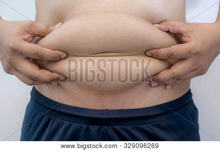 Overweight Asian Obese Men, He Is Feeling Ill And Worried About His Excess Weight. He Squeezed His B