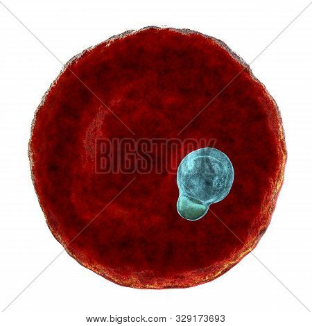 The Malaria-infected Red Blood Cell. 3d Illustration Showing Parasite Plasmodium Malariae In The Sta