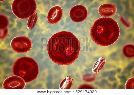 The Malaria-infected Red Blood Cell. 3d Illustration Showing Parasite Plasmodium Malariae In The Sta