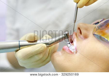Close Up Of Dental Polishing Treatment From Dental Deposit And Odontolith In Dental Clinic. Dentist 
