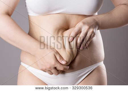 Flabby Belly After Pregnancy, Overweight Female Body On Gray Background