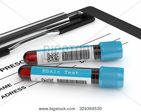 3d Render Of Hba1c Blood Tubes Lying On Clipboard. Test For Diabetes Concept.