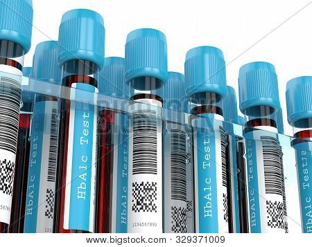 3d Render Of Hba1c Blood Tubes In Rack. Test For Diabetes Concept.