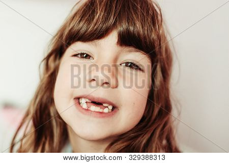 Close-up Portrait Of Girl With No Frontal Teeth. Teeth Eruption, Baby Teeth