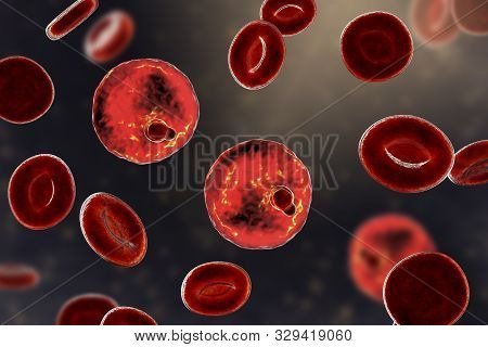 The Malaria-infected Red Blood Cell. 3d Illustration Showing Parasite Plasmodium Malariae In The Sta