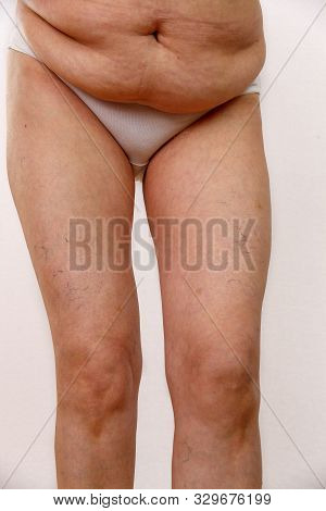 An Elderly Woman In White Panties Shows The Folds On Her Abdomen On A White Isolated Background.