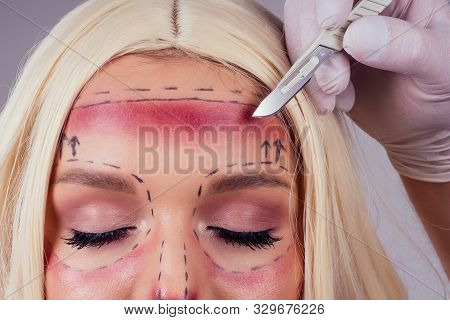 Surgery Victim Beauty Drawing Line Make Up Face Female Before Operation Syringe.halloween Concept