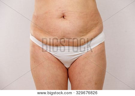 An Elderly Woman In White Panties Shows The Folds On Her Abdomen On A White Isolated Background.