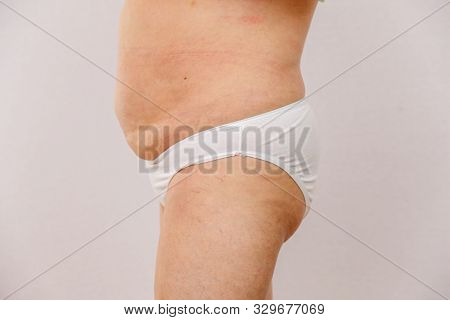 Elderly Woman In White Panties Shows Cellulite And Varicose Veins On A Light Isolated Background. Co