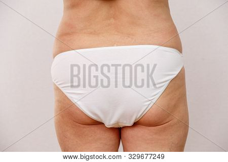 Elderly Woman In White Panties Shows Cellulite And Varicose Veins On A Light Isolated Background. Co