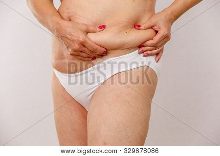 An Elderly Woman In White Panties Shows The Folds On Her Abdomen On A White Isolated Background.