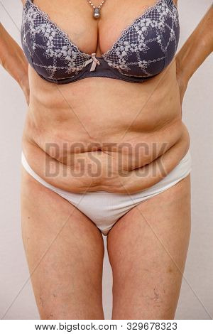 An Elderly Woman In White Panties Shows The Folds On Her Abdomen On A White Isolated Background.