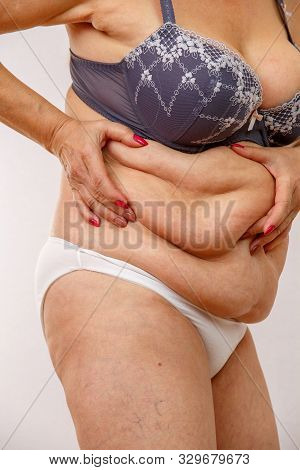 An Elderly Woman In White Panties Shows The Folds On Her Abdomen On A White Isolated Background.