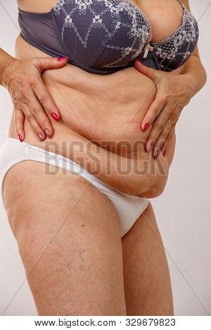 An Elderly Woman In White Panties Shows The Folds On Her Abdomen On A White Isolated Background.