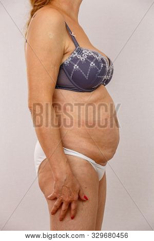 An Elderly Naked Woman Shows Her Body From All Sides. You Can See All The Nuances Of The Elderly Bod