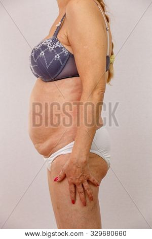 An Elderly Naked Woman Shows Her Body From All Sides. You Can See All The Nuances Of The Elderly Bod