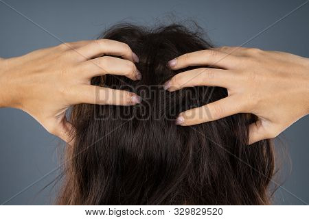 Young Woman Scratching Her Itchy Head Scalp