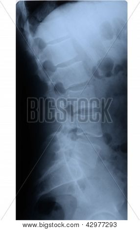 Tilbage skelet billede