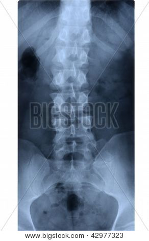 Tilbage skelet billede