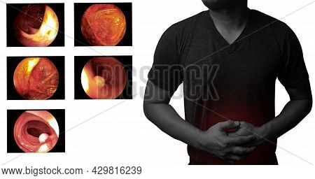 Male Having Stomachache Or Gastroenterologists  And Showing Colonoscopy Report, Medical Healthcare C