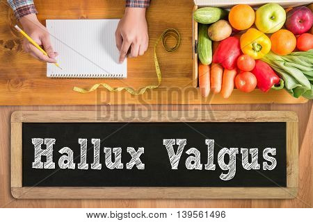 Hallux Valgus