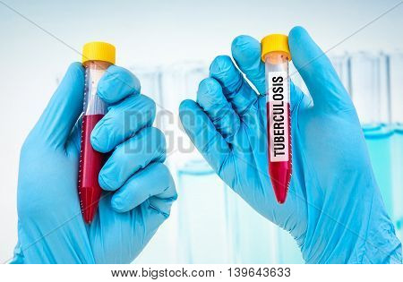 Test-tube With Blood Sample For Tuberculosis Test
