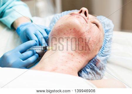 Beautician makes biorevitalization to young woman. The cosmetic procedures for the face. Beauty treatments in the spa salon. Facial Skin Care.