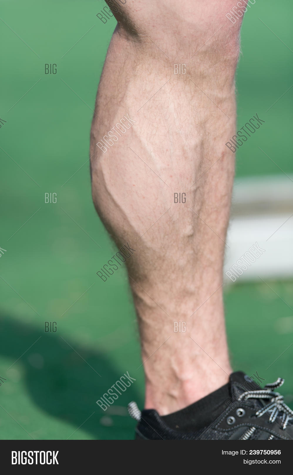 Muscular Leg Vein Image & Photo (Free Trial) Bigstock