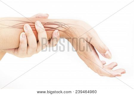 Forearm Nerve Injury White Background Forearm Pain